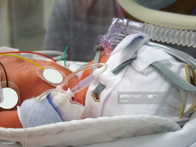 a few day´s old preemie in hospital lying in an incubator